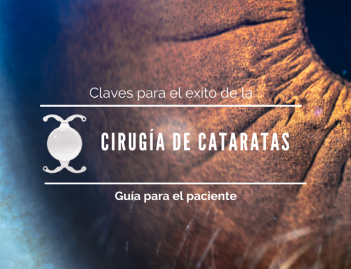 Claves para el éxito de la cirugía de cataratas. Guía para el paciente